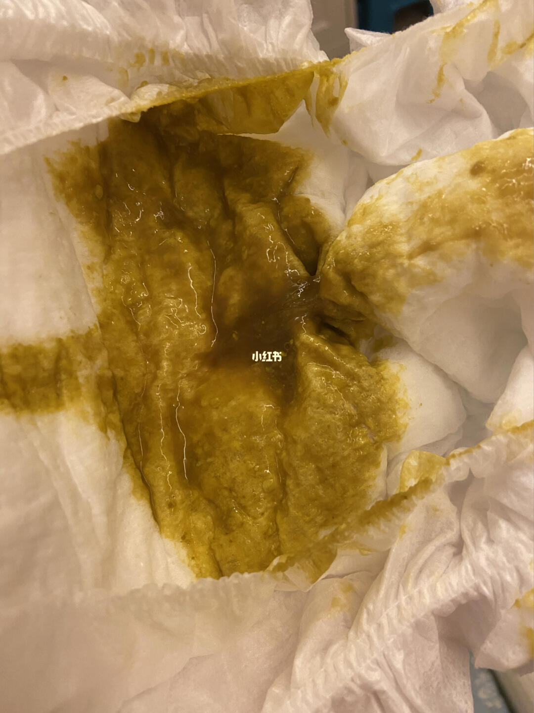 关于六个月宝宝腹泻伴随粘液的问题